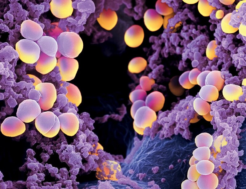 Staphylococcus aureus