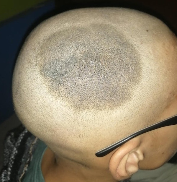 Bigpicture ru physical mutations that prove were all one of a kind life is awesome beautiful interesting shocking mind blowing humanity 032922 7