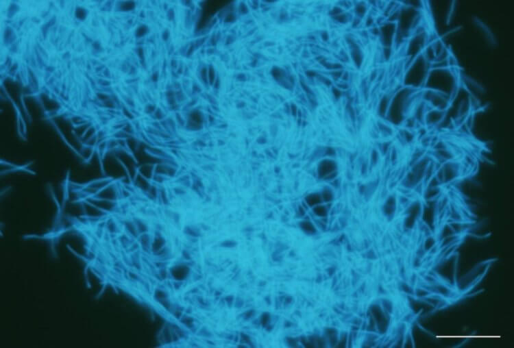 Почему подземная экосистема важна для науки и поиска внеземной жизни. Разновидность метанобактерий, которые вырабатывают метан. Обнаружены в образцах угольного пласта на глубине 2 км под дном Тихого океана у берегов Японии. Полоса представляет собой 10 микрометров. Источник изображения: phys.org. Фото.