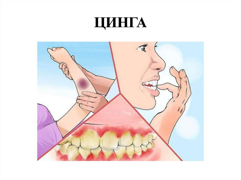 6. Многократно забытая и открытая заново болезнь