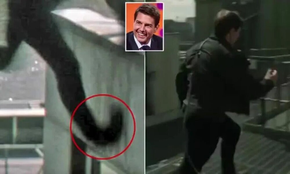 6. Раздробленная лодыжка Тома Круза