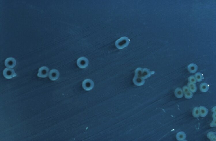 Что такое брюшной тиф. Колония возбудителей брюшного тифа, Источник изображения: wikipedia.org. Что такое брюшной тиф. Колония возбудителей брюшного тифа, Источник изображения: wikipedia.org. Фото.