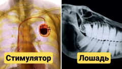 Рентгеновские изображения, показывающие привычное с новой стороны